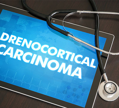 Global Adrenocortical Carcinoma Drugs Market 2019-2023